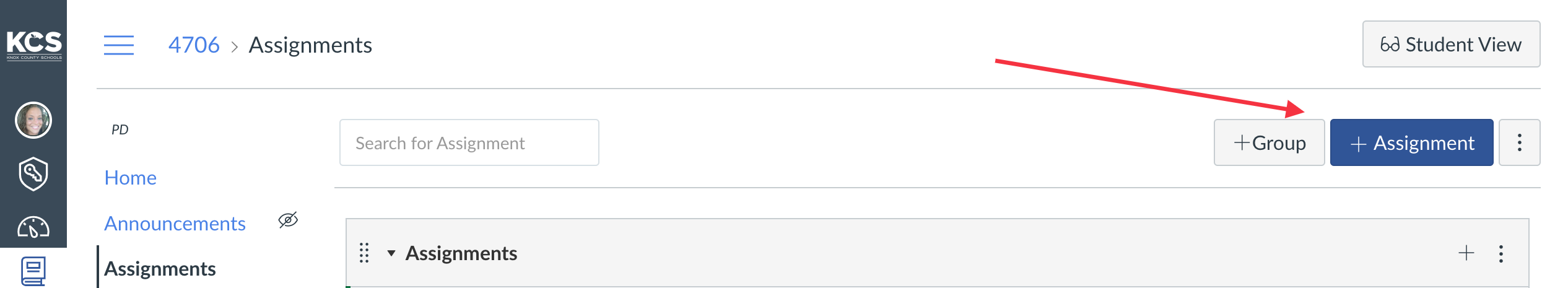 Click on +Assignment