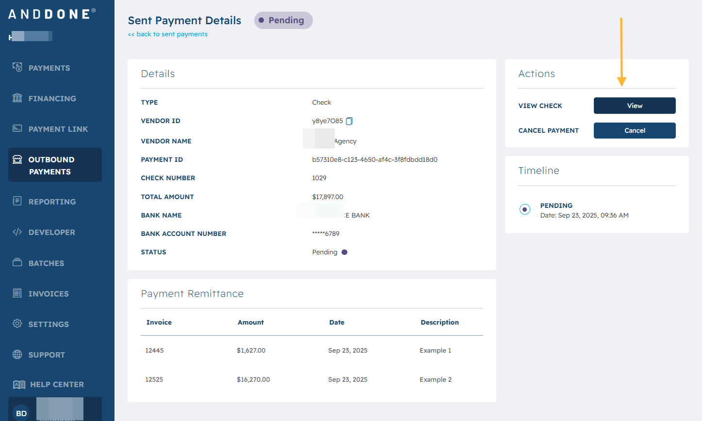 To view the check, click on VIEW