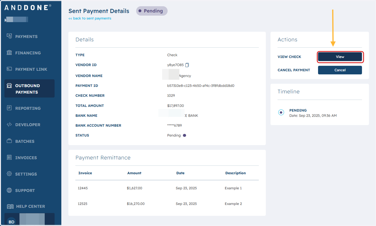 To view the check, click on VIEW