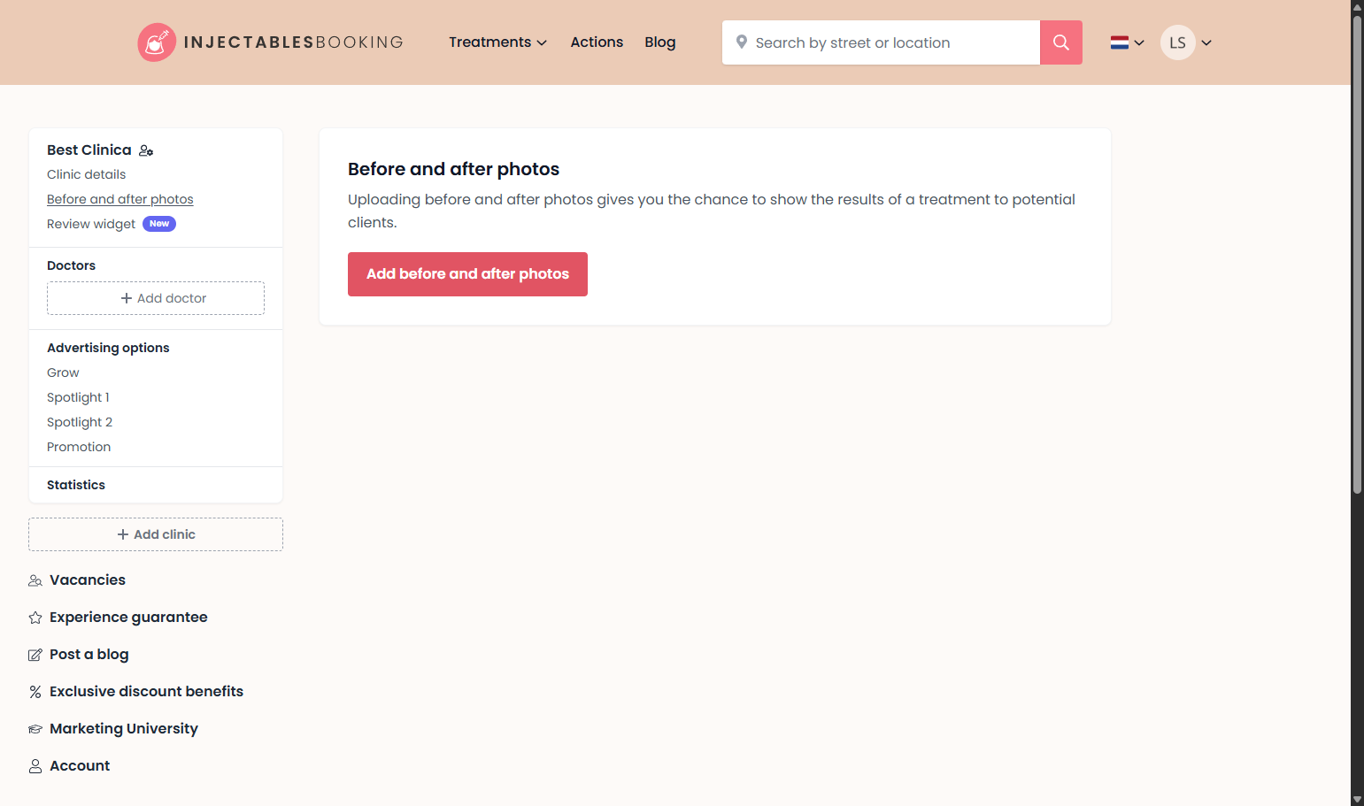 Click on ‘Add Before and After Photos’. Klik op ‘Voor- en nafoto’s toevoegen’.